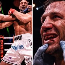 Ex-UFC champion Luke Rockhold quits in brutal bare-knuckle fight with Mike Perry after having his TEETH knocked out